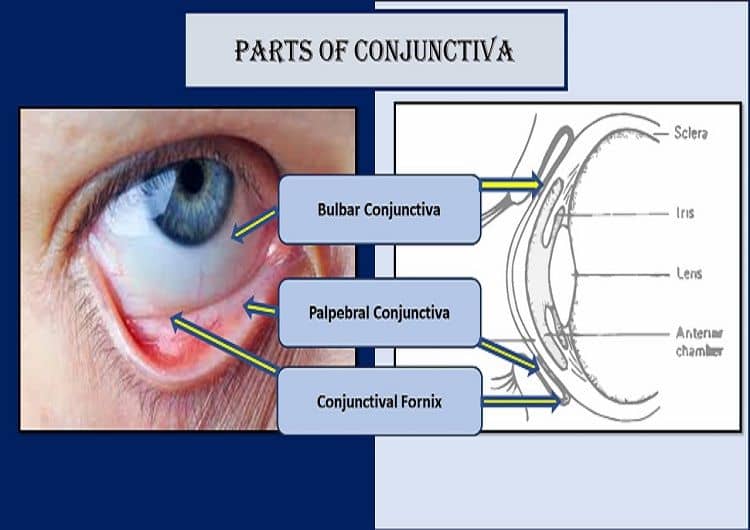 Parts of the conjunctiva
